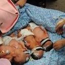 宜春市人民医院做试管生孩孩价格多少？附试管生孩孩费用一览