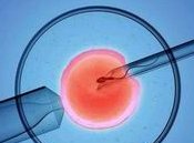 女性垂体微腺瘤做试管婴儿助孕有什么影响吗？