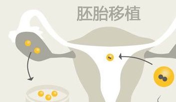 钦州试管婴儿多少钱？医疗费用花销看这里